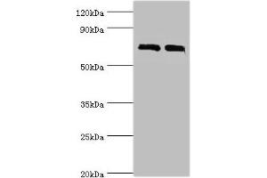 Western blot All lanes: DHX58 antibody at 12 μg/mL Lane 1: 293T whole cell lysate Lane 2: Rat kidney tissue Secondary Goat polyclonal to rabbit IgG at 1/10000 dilution Predicted band size: 77 kDa Observed band size: 77 kDa (DHX58 抗体  (AA 389-678))