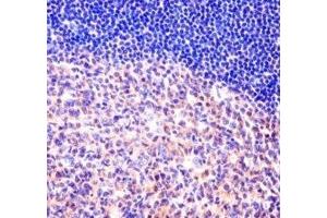 MCM6 antibody immunohistochemistry analysis in formalin fixed and paraffin embedded human tonsil tissue. (MCM6 抗体  (AA 80-109))