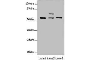 Western blot All lanes: ERO1L antibody at 2. (ERO1L 抗体  (AA 24-260))