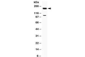Western blot testing of human MCF7 cell lysate with TIAM1 antibody at 0. (TIAM1 抗体  (AA 1518-1554))