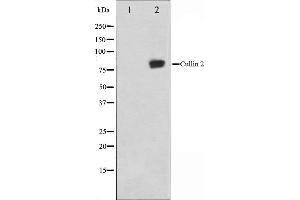 Western blot analysis on LOVO cell lysate using Cullin 2 Antibody,The lane on the left is treated with the antigen-specific peptide. (Cullin 2 抗体  (C-Term))