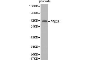 Western Blotting (WB) image for anti-Protein S (PROS) (AA 405-676) antibody (ABIN6218667) (PROS1 抗体  (AA 405-676))