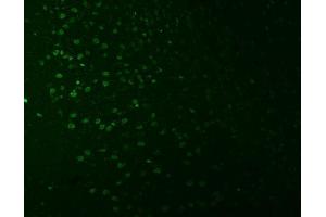 IF analysis of SNRNP27 using anti-SNRNP27 antibody (ABIN7599614).