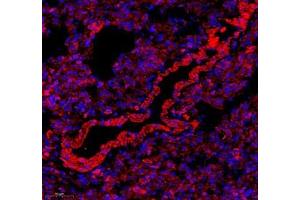 Immunofluorescence (Paraffin-embedded Sections) (IF (p)) image for anti-Major Vault Protein (MVP) antibody (ABIN7074548)