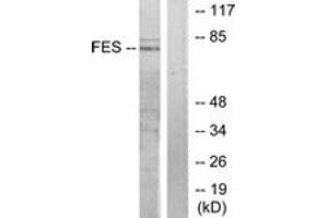 Western blot analysis of extracts from HuvEc cells, treated with serum 20% 30', using FES Antibody. (FES 抗体  (AA 131-180))