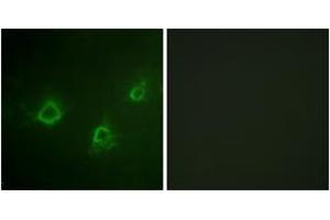 Immunofluorescence analysis of COS7 cells, using PLCG1 (Ab-1253) Antibody. (Phospholipase C gamma 1 抗体  (AA 1221-1270))