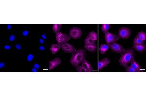 anti-Eukaryotic Translation Initiation Factor 2 alpha Kinase 4 (EIF2AK4) antibody