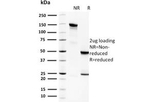 SDS-PAGE Analysis Purified Spermidine Monoclonal Antibody (CPTC-SAT1-3). (SAT1 抗体)