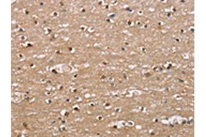 The image on the left is immunohistochemistry of paraffin-embedded Human brain tissue using ABIN7189673(ADGRB2 Antibody) at dilution 1/25, on the right is treated with synthetic peptide. (BAI2 抗体)