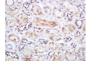 Immunohistochemistry (Paraffin-embedded Sections) (IHC (p)) image for anti-Solute Carrier Family 25 (Mitochondrial Carrier, Dicarboxylate Transporter), Member 10 (SLC25A10) (AA 201-287) antibody (ABIN752293)