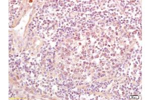 Immunohistochemistry (IHC) image for anti-NADH Dehydrogenase (Ubiquinone) Fe-S Protein 1, 75kDa (NADH-Coenzyme Q Reductase) (NDUFS1) (AA 51-150) antibody (ABIN750703)