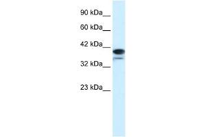 PARP6 antibody used at 1. (PARP6 抗体)