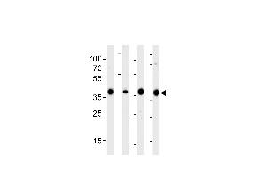 Western blot analysis of lysates from 293,RD,mouse NIH/3T3,rat L6 cell line (from left to right),using ALDOA Antibody (N-term) (ABIN389191 and ABIN2839354). (ALDOA 抗体  (N-Term))