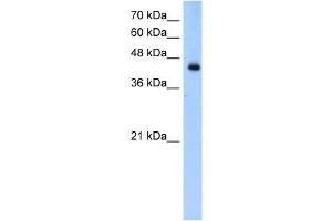 Transfected 293T; WB Suggested Anti-ACADL Antibody Titration: 0. (ACADL 抗体  (N-Term))