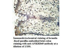 Image no. 1 for anti-Ankyrin Repeat Domain 49 (ANKRD49) antibody (ABIN1574707) (ANKRD49 抗体)