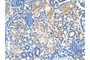 SLC38A1 antibody was used for immunohistochemistry at a concentration of 4-8 ug/ml to stain EpitheliaI cells of renal tubule (arrows) in Human Kidney. (SLC38A1 抗体  (Middle Region))
