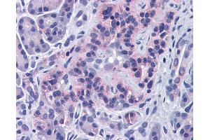 Immunohistochemistry (IHC) image for anti-Sirtuin 4 (SIRT4) (Middle Region) antibody (ABIN2779654) (SIRT4 抗体  (Middle Region))