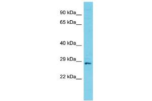 Host: Rabbit Target Name: C11orf70 Sample Type: Jurkat Whole Cell lysates Antibody Dilution: 1. (C11ORF70 抗体  (C-Term))