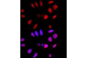 Immunofluorescence (IF) image for anti-Ataxin 3 (ATXN3) (AA 1-364) antibody (ABIN3021829)