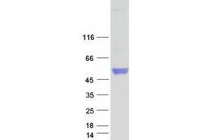 Validation with Western Blot