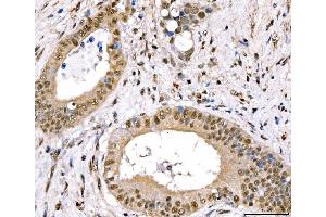 IHC analysis of CRTC3 using anti-CRTC3 antibody (ABIN7599779).