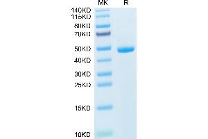 IL-20 Protein (AA 25-176) (Fc Tag)