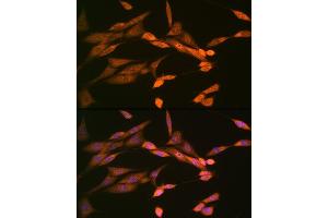 Immunofluorescence analysis of NIH-3T3 cells using DISC1 Rabbit mAb (ABIN7266799) at dilution of 1:100 (40x lens). (DISC1 抗体)