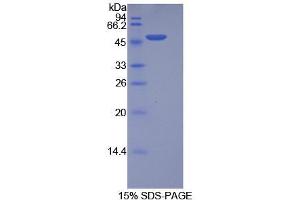 SDS-PAGE analysis of Human Integrin alpha 5 Protein. (ITGA5 蛋白)