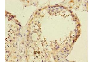 Immunohistochemistry of paraffin-embedded human testis tissue using ABIN7144788 at dilution of 1:100 (Ataxin 1 抗体  (AA 346-475))
