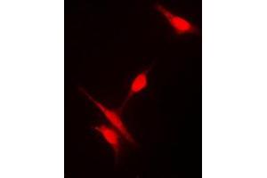Immunofluorescent analysis of Histone Deacetylase 10 staining in Jurkat cells. (HDAC10 抗体  (N-Term))