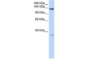 WB Suggested Anti-TMEM16C Antibody Titration:  0. (ANO3 抗体  (C-Term))