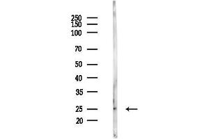 anti-Regulator of G-Protein Signaling 17 (RGS17) (N-Term) antibody