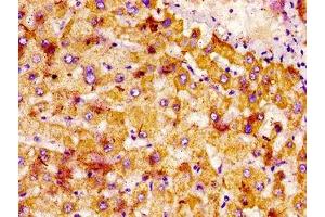 IHC image of ABIN7161191 diluted at 1:400 and staining in paraffin-embedded human liver tissue performed on a Leica BondTM system. (Netrin 1 抗体  (AA 186-478))