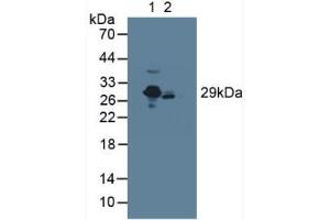 Western blot analysis of (1) Rat Serum and (2) Mouse Serum. (CRP 抗体  (AA 17-224))