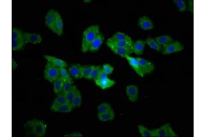 Immunofluorescence staining of HepG2 cells with ABIN7171895 at 1:233, counter-stained with DAPI. (Tetraspanin 9 抗体  (AA 107-203))
