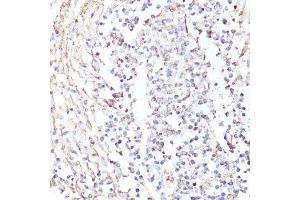 Immunohistochemistry (Paraffin-embedded Sections) (IHC (p)) image for anti-Receptor tyrosine-protein kinase erbB-2 (ErbB2/Her2) (C-Term) antibody (ABIN6140248)