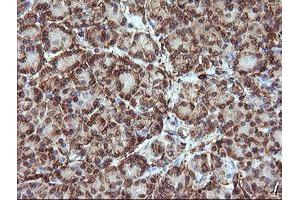Image no. 4 for anti-Tripartite Motif Containing 38 (TRIM38) (AA 1-265) antibody (ABIN1490685)