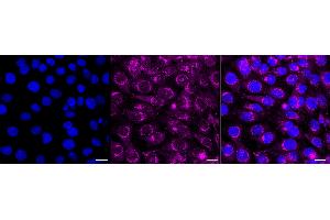 Immunocytochemical staining of HT- cells with Amyloid beta precursor protein antibody (ABIN7797593), 1:1,000). (Recombinant APP 抗体)