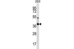 Western blot analysis in 293 cell line lysates (35ug/lane) using NKX2-2  Antibody . (Nkx2-2 抗体  (Middle Region))