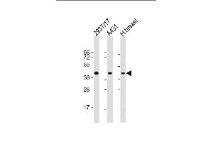 All lanes : Anti-ERLIN2 Antibody (C-term) at 1:2000 dilution Lane 1: 293T/17 whole cell lysate Lane 2: A431 whole cell lysate Lane 3: human breast lysate Lysates/proteins at 20 μg per lane. (ERLIN2 抗体  (C-Term))