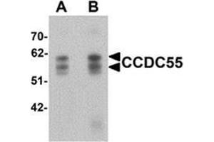 Western blot analysis of CCDC55 in human brain tissue lysate with CCDC55 antibody at (A) 0.
