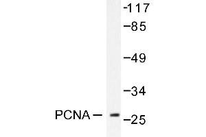 Image no. 1 for anti-Proliferating Cell Nuclear Antigen (PCNA) antibody (ABIN271780) (PCNA 抗体)