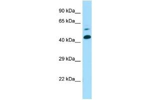 Host: Rabbit Target Name: Ctns Sample Type: Mouse Lung lysates Antibody Dilution: 1. (CTNS 抗体  (Middle Region))