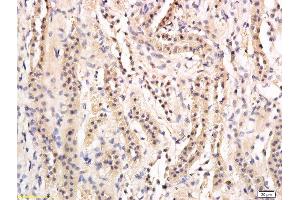 Formalin-fixed and paraffin embedded rat kidney labeled with Anti-phospho-AQP2(Ser269) Polyclonal Antibody, Unconjugated  followed by conjugation to the secondary antibody and DAB staining (AQP2 抗体  (pSer269))