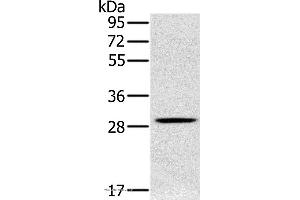 Western blot analysis of Human testis tissue, using CLIC1 Polyclonal Antibody at dilution of 1:400