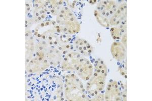 Immunohistochemistry of paraffin-embedded mouse kidney using SET antibody (ABIN5973657) at dilution of 1/100 (40x lens). (SET/TAF-I 抗体)