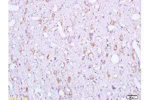 Formalin-fixed and paraffin embedded rat brain labeled with Rabbit Anti Sigma1R/OPRS1/Sigma Receptor Polyclonal Antibody, Unconjugated (ABIN709841) at 1:200 followed by conjugation to the secondary antibody and DAB staining (SIGMAR1 抗体  (AA 21-120))