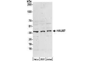 anti-HAUS Augmin-Like Complex, Subunit 7 (HAUS7) (AA 318-368) antibody