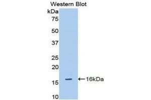 Western blot analysis of the recombinant protein. (ADAMTS1 抗体  (AA 854-967))