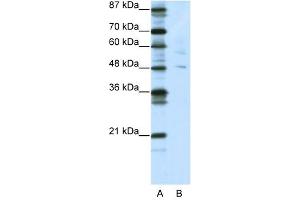 PLAGL1 antibody (20R-1207) used at 0. (PLAGL1 抗体  (N-Term))
